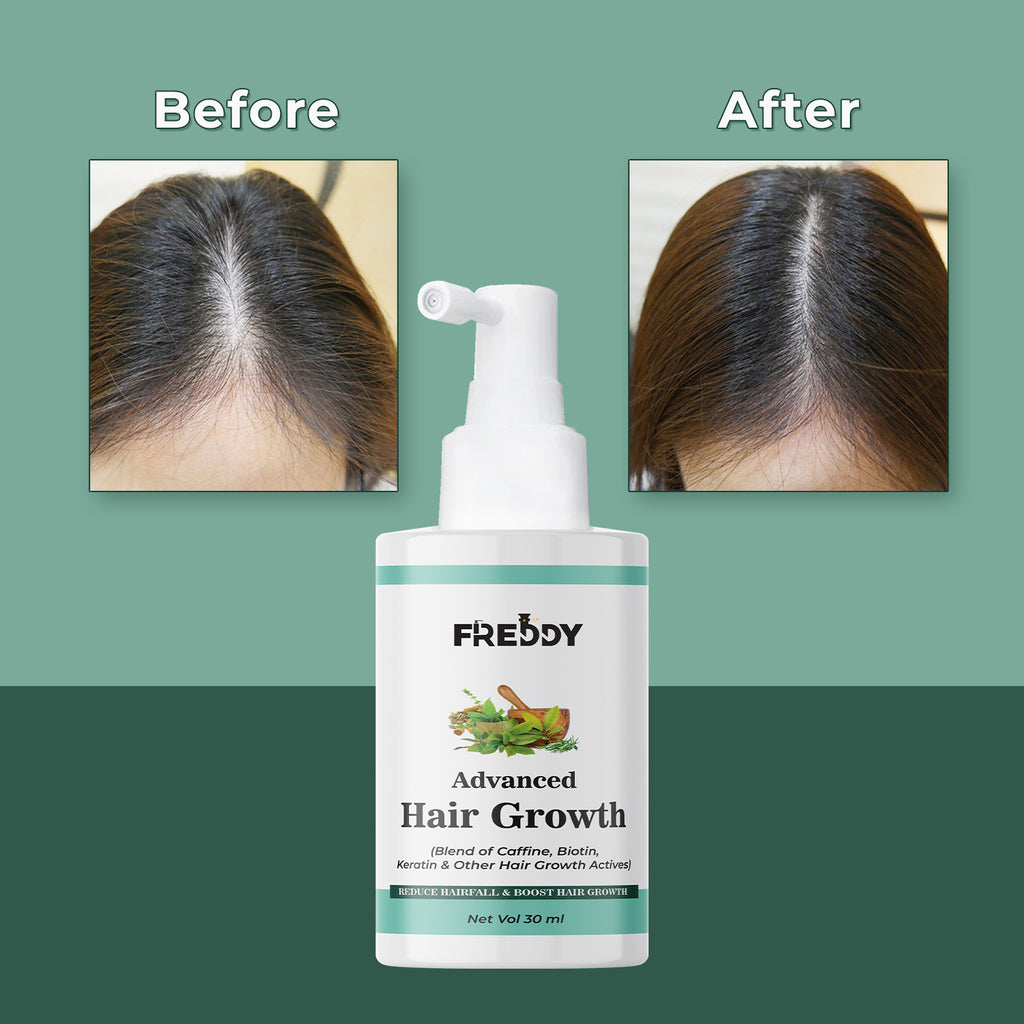 Hair Growth Serum Concentrate for Women & Men (30 ml)