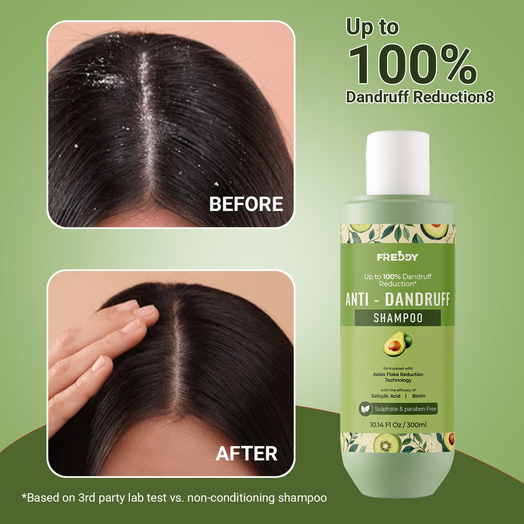 Freddy Anti-Dandruff Shampoo 100%  Dandruff Reduction With Salicylic Acid,  Piroctone Olamine & Biotin - Strengthens &  Nourishes Hair (250 MI