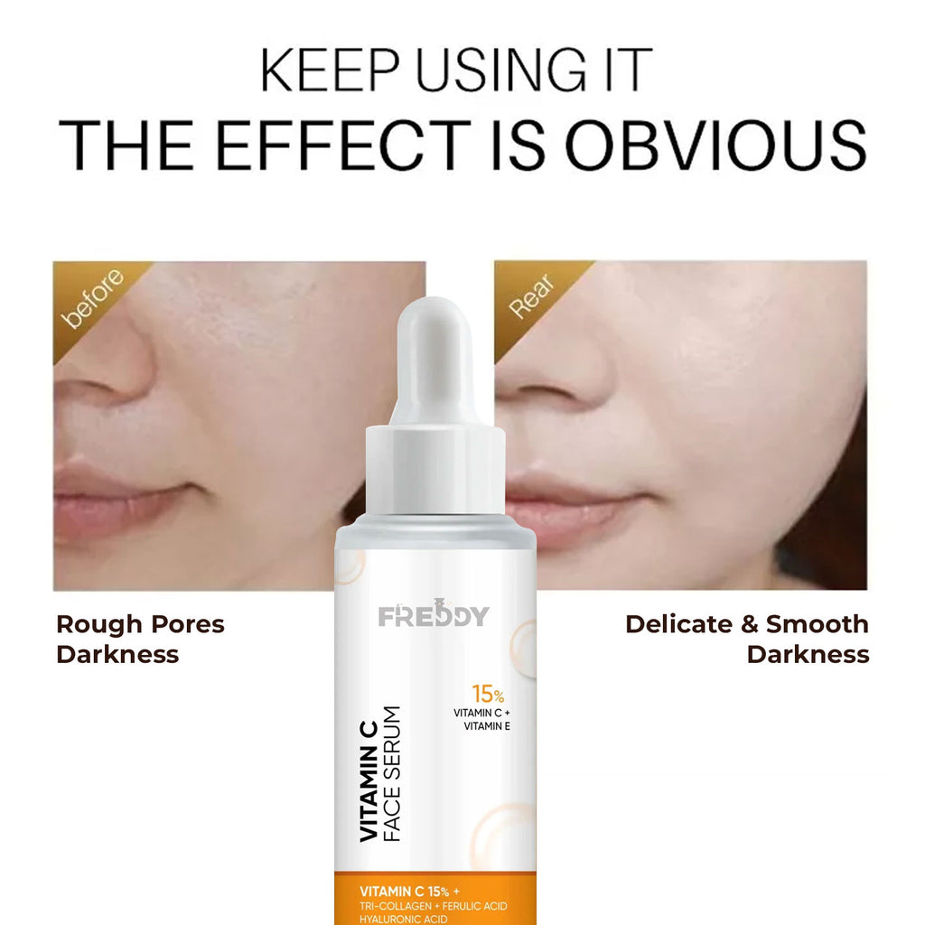 Freddy 15% Vitamin C Serum with Vitamin E &amp; Hyaluronic Acid (30 ml)