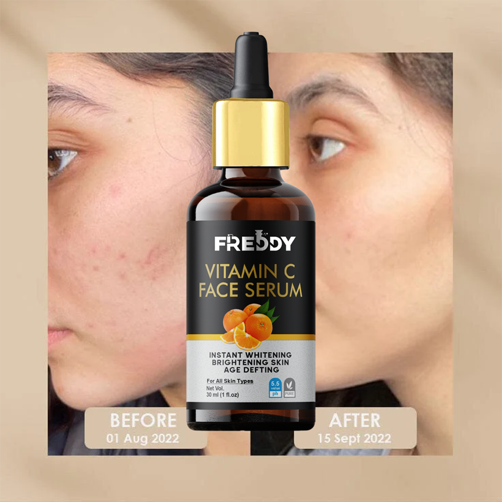 FREDDY Vitamin C Face Serum (30ml)