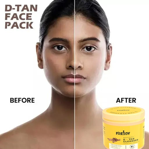 FREDDY De-Tan Face And Body Massage Pack Reduces Dark Spots Reduces Sun Tan (100 MI)